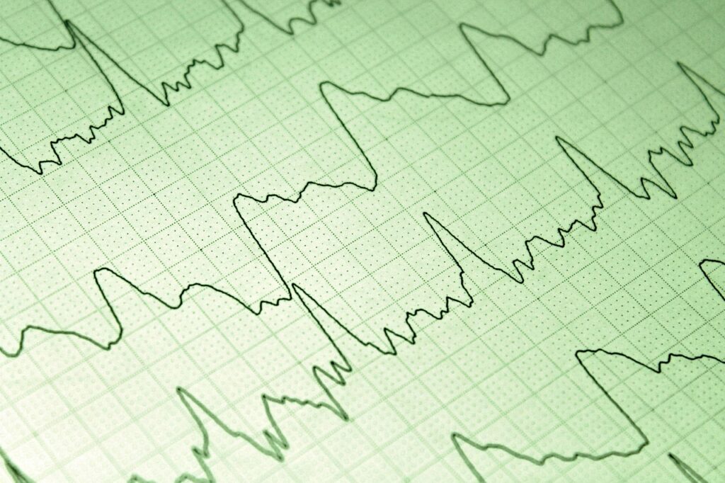 初回商談で使える効果的なトークスクリプトとは？