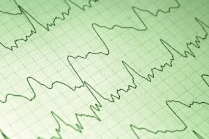 初回商談で使える効果的なトークスクリプトとは？